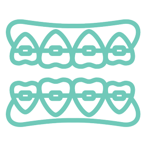 teeth-alignment-istanbul